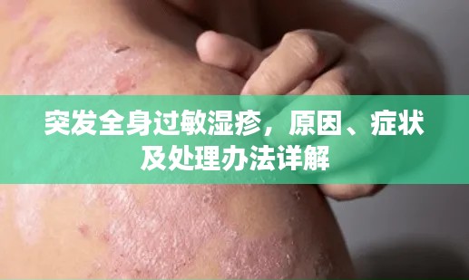 突发全身过敏湿疹,原因、症状及处理办法详解